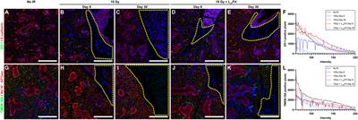 Laminin-1 Peptides Conjugated to Fibrin Hydrogels Promote Salivary Gland Regeneration in Irradiated Mouse Submandibular Glands